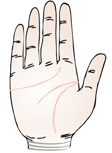 手腕線（動脈紋）