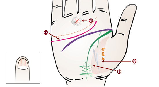 掌紋分析：高血壓掌徵