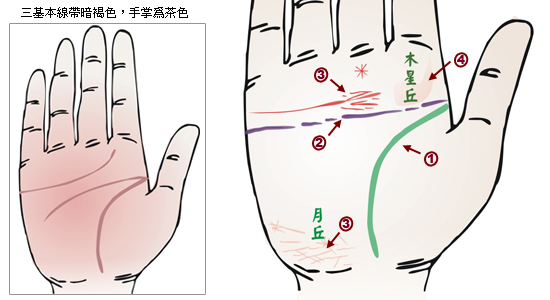 掌纹分析：脑溢血掌徵